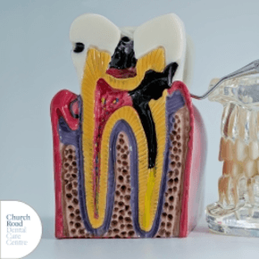 Cross-section dental model showing tooth structure, roots, and internal layers with a toothbrush and teeth model beside it