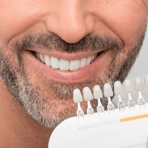 A man smiles, showing the whiteness of his teeth alongside a tooth whitening guide.